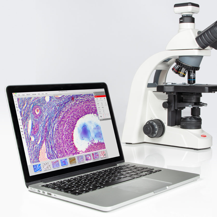 BA310E Trinocular (without 100X)